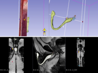 Virtual urethra model