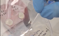 Platelet rich plasma patch